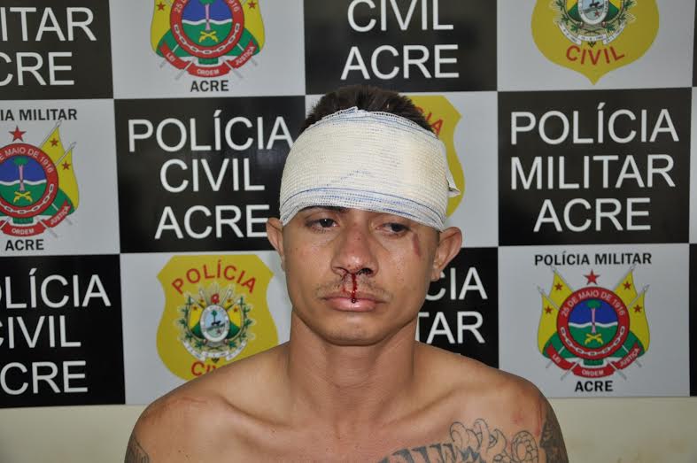 O acusado foi conduzido ao Pronto Socorro devido ele ter caído e se machucado durante a fuga/Foto: Selmo Melo/ContilNet Notícias preso-assalto-pn