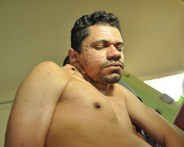 Segundo a polícia, Márcio Rodrigues atacava as crianças no meio da rua/Foto: Selmo Melo/ContilNet Notícias DSC 0271