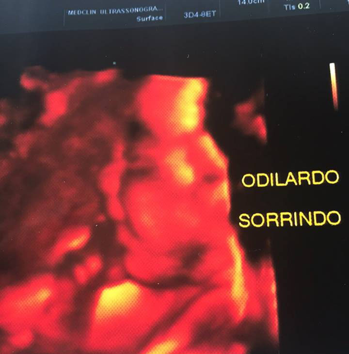 Advogado publica imagem de ultrassom da gravides de sete meses da esposa e diz que filho bebê aparece sorrindo/Foto: Arquivo pessoal 10537096 816561168431135 8413687163287193502 n