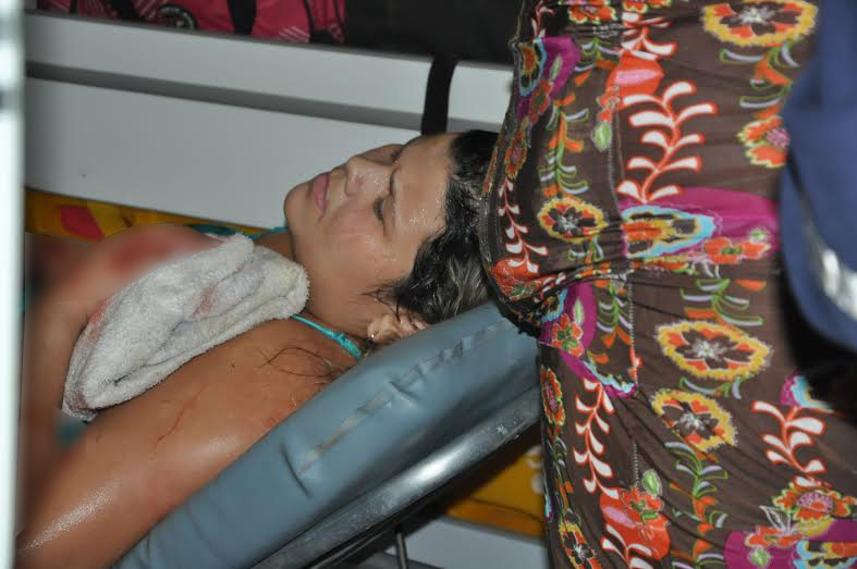 O Serviço de Atendimento Móvel de Urgência (Samu) socorreu a vítima e a conduziu, em estado grave, ao Pronto Socorro/Foto: Selmo Melo/ContilNet Notícias estado-grave