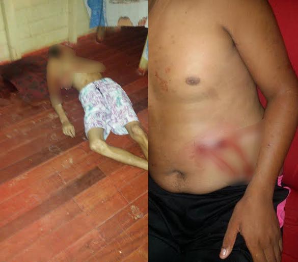 Jovem foi assassinado e irmão atingido por um tiro/Foto: Selmo Melo/ContilNet Notícias morterecandto