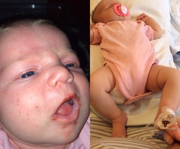 A menina Brook, hospitalizada devido à infecção por herpes (Foto: Claire Henderson/ Reprodução Facebook)