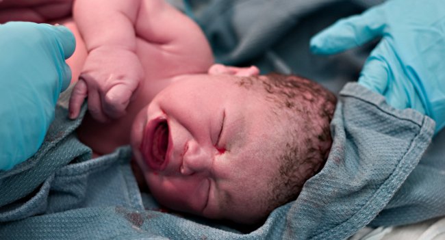 Projeto consegue reduzir cesarianas em 42 hospitais do país