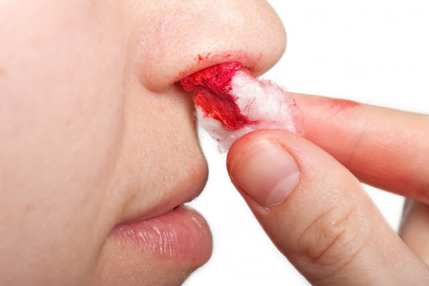 10 doenças que podem matar qualquer pessoa em um dia 10 doenças que podem matar qualquer pessoa em um dia