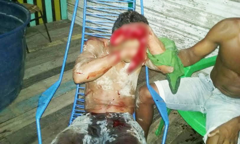 Bebedeira e jogo quase termina em morte no Panorama