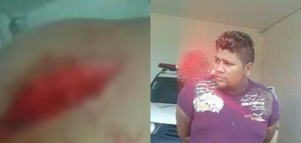 Homem tenta matar sua companheira com golpes de faca, no bairro Sobral
