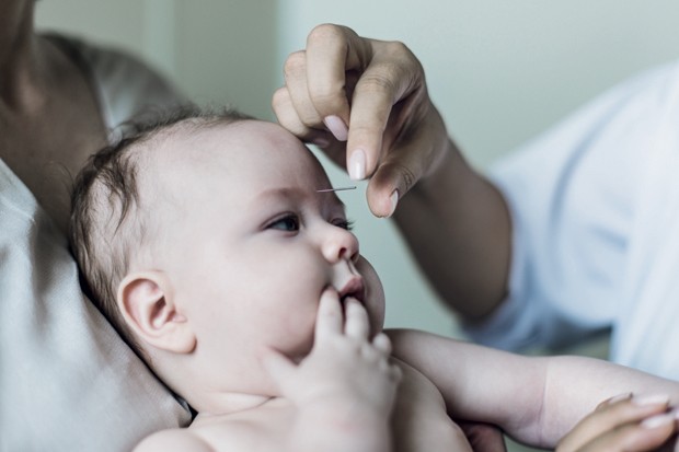Acupuntura para crianças, bebês e grávidas