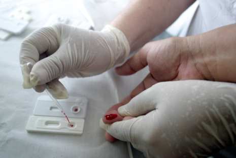 Lacen não tem kits de exames de hepatites e HIV; outras unidades também estão sem
