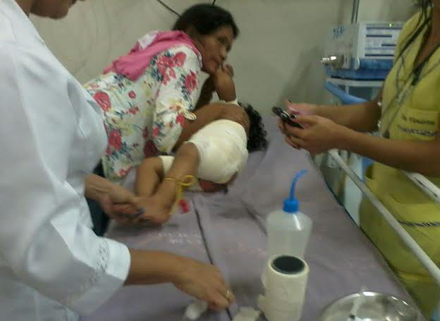 Criança que teve queimadura de 3º grau após cair em panela quente receberá alta