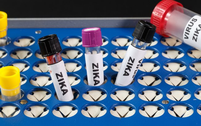 Cientistas brasileiros descobrem novo distúrbio cerebral em adultos ligado ao zika vírus