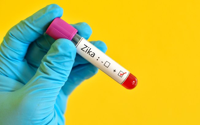 Rio Branco confirma 15 casos de zika e apresenta quase mil suspeitas de chikungunya