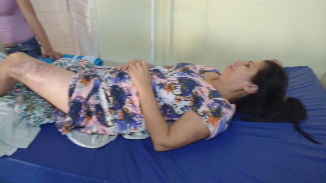 “Foi um milagre não ter quebrado a perna”, diz pré-candidata acidentada em Sena