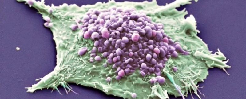 vacina-universal-cancer
