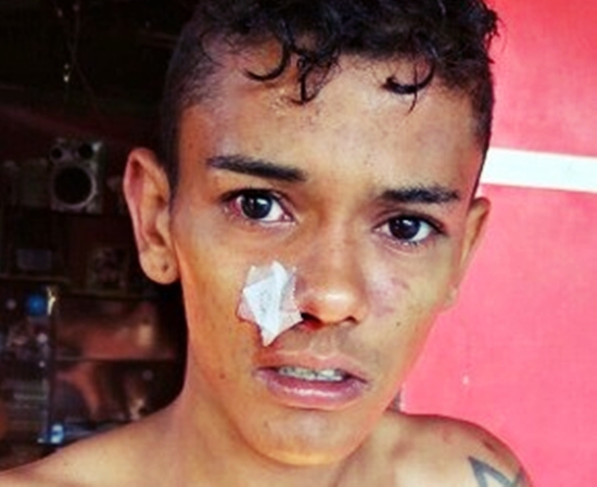 Mãe acusa polícia de agredir filho; policial desmente e afirma que foram populares