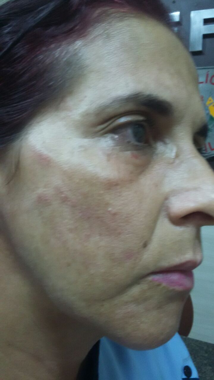 Funcionária de hospital diz ter sido agredida por esposa de “Buldogue”