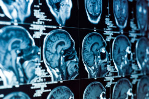 2506_tratamento-com-botox-em-neurologia-uma-ajuda-terapeutica-muito-alem-da-estetica