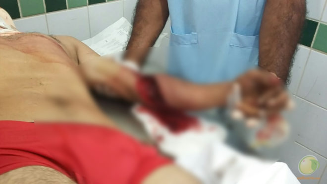 Motoqueiro fica em estado grave após colidir com caminhão na BR-317