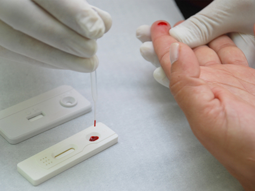 Casos de sífilis voltam a aumentar em todo Brasil; veja os sintomas e como prevenir