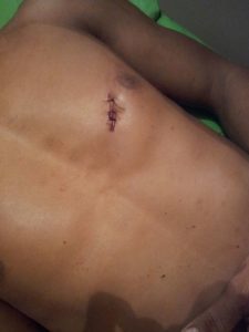 um jovem de apenas 22 anos foi assassinado com um golpe de faca apunhalado  na região do peito/Foto: Reprodução.