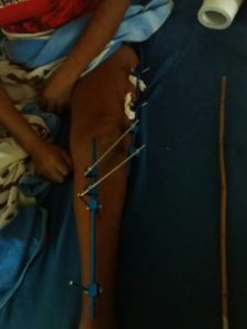 whatsapp-image-2016-11-10-at-11-46-37