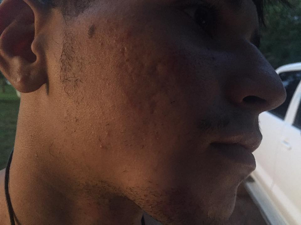 caseiroq