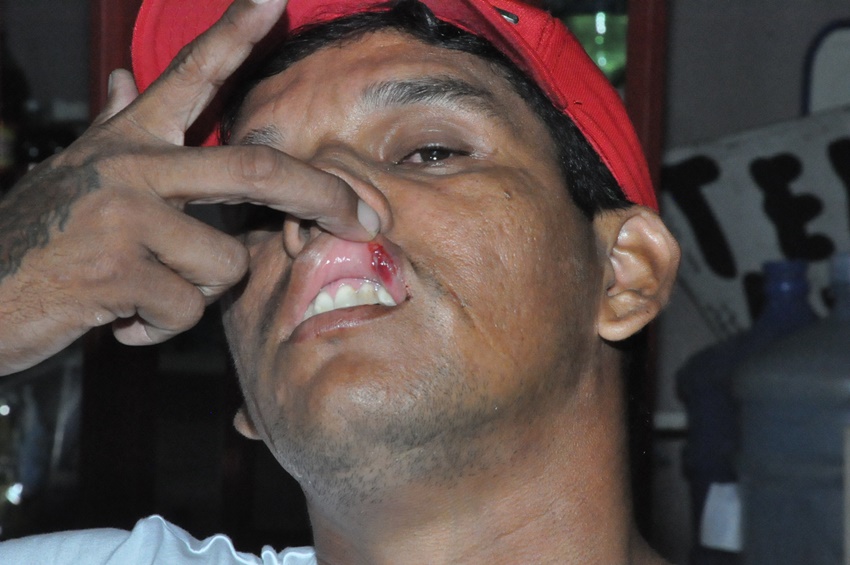 Dono de bar, no bairro Seis de Agosto, diz ter sido agredido por policiais