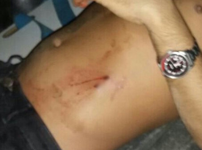 Tiroteio em Sena Madureira deixa três pessoas feridas durante o fim de semana
