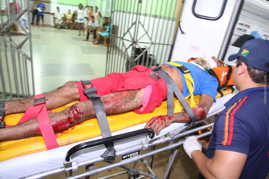 Acidente na Estrada do Pacífico deixa dois feridos; condutor de carro foge do local