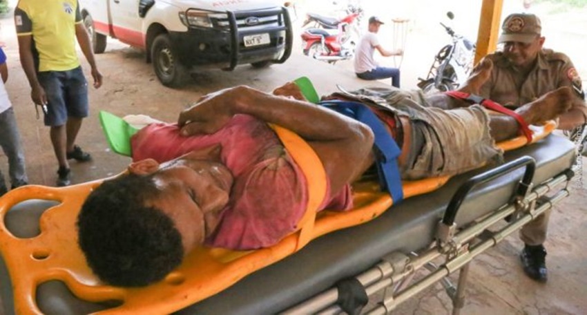 Homem é atingido por tiros em Epitaciolândia e dois projéteis ficam alojados no seu corpo