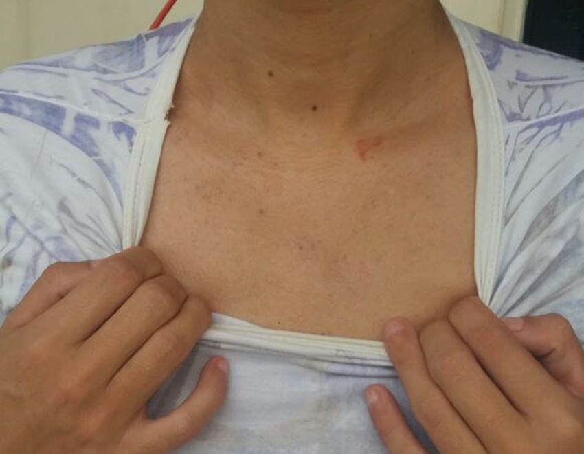Estudante afirma que apanhou e foi preso em Rio Branco apenas por ser homossexual