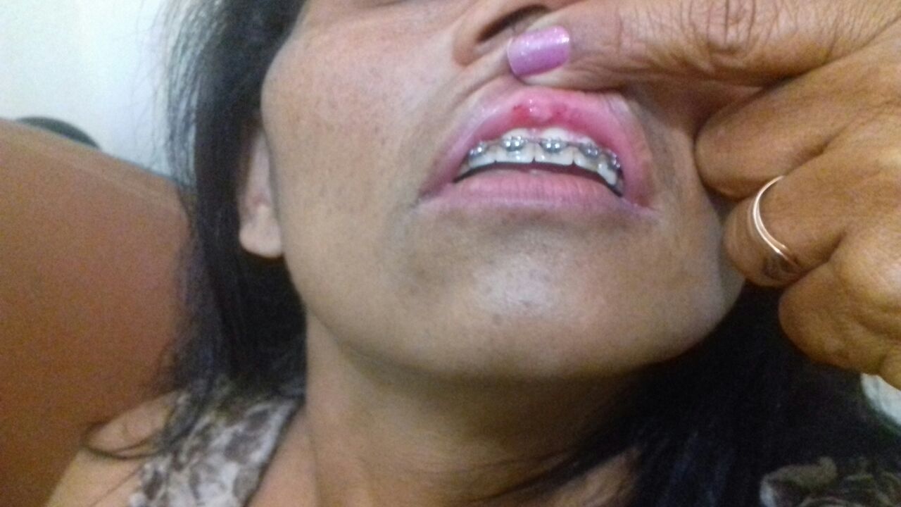 Policial da reserva é levado à delegacia acusado de agredir mulher no bairro Sobral