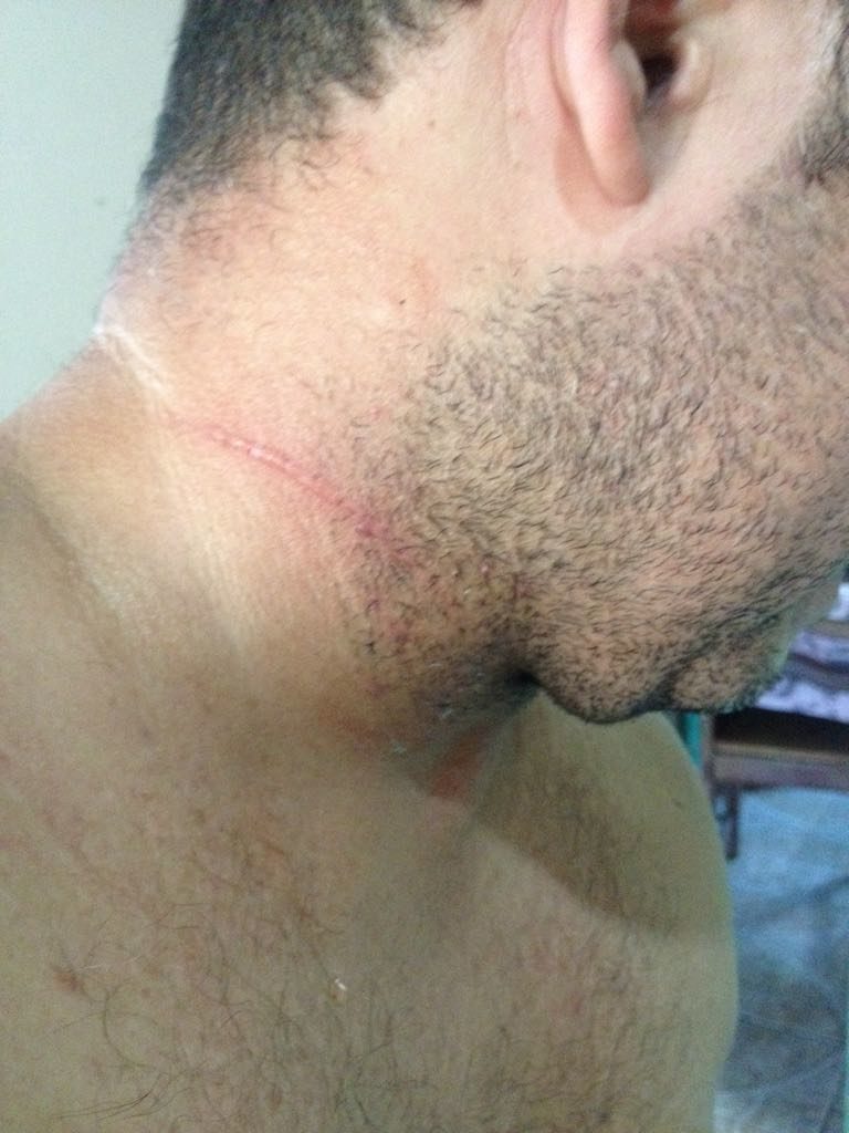 Linha de pipa com cerol quase provoca tragédia no bairro da Paz; veja fotos