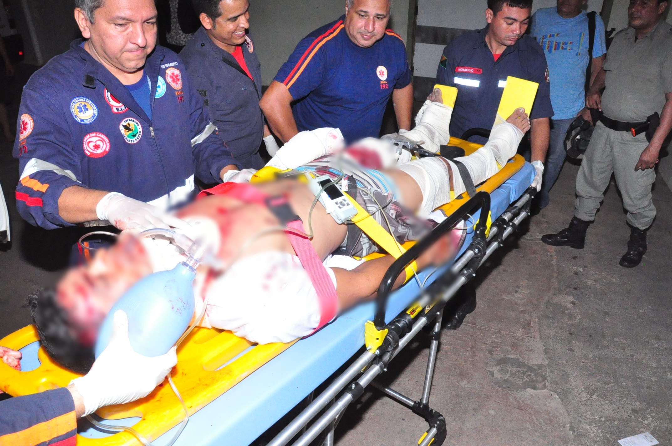 Motociclista perde o controle ao passar sobre quebra-molas e bate de frente com carro