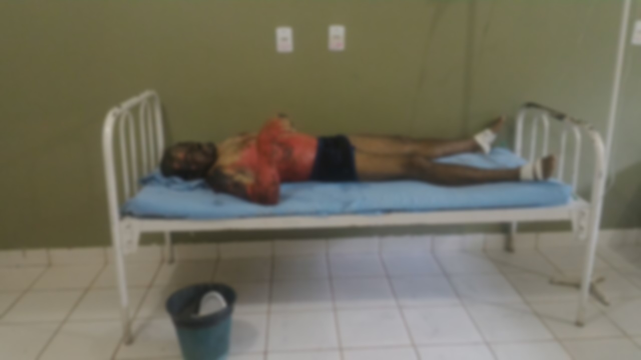 Homem que foi preso por furtar uma cabeça de alho morre queimado em delegacia do interior