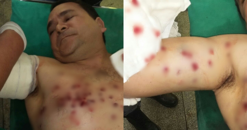 Comerciante é atingido por tiro de escopeta após reagir a assalto em Tarauacá