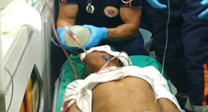 Flanelinha é baleado três vezes na cabeça enquanto trabalhava