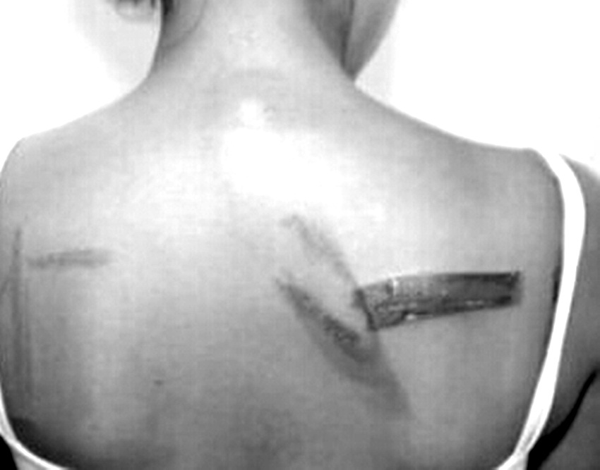 Salva pela polícia: jovem de 15 anos é torturada e quase esquartejada em Brasileia