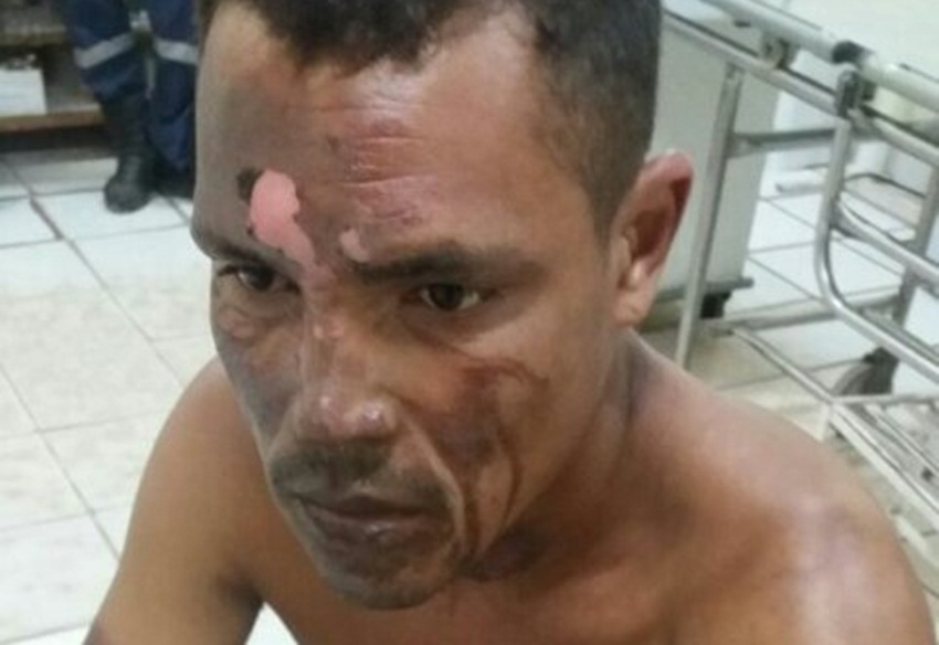 “Diabão” tenta incendiar garagem em Sena Madureira e acaba queimando o próprio rosto