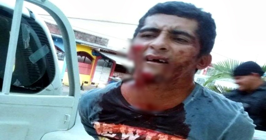 COE prende suspeito de assassinar vigilante da maternidade em Cruzeiro do Sul