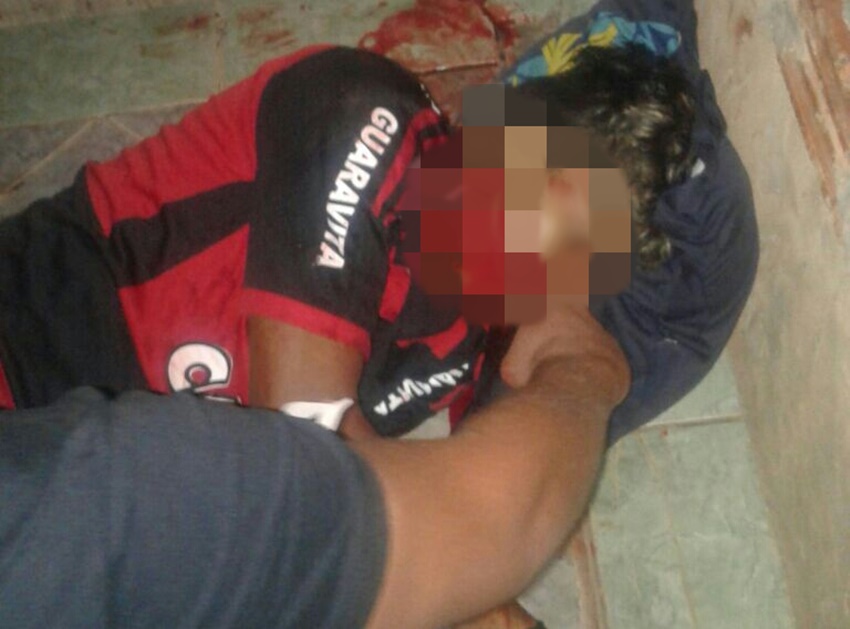 Jovem de 18 anos é atingido com vários disparos no bairro Defesa Civil