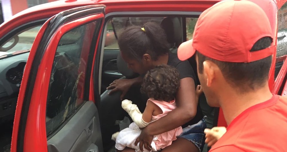 Bebê sofre queimaduras graves após cair sobre brasas de carvão em casa de farinha