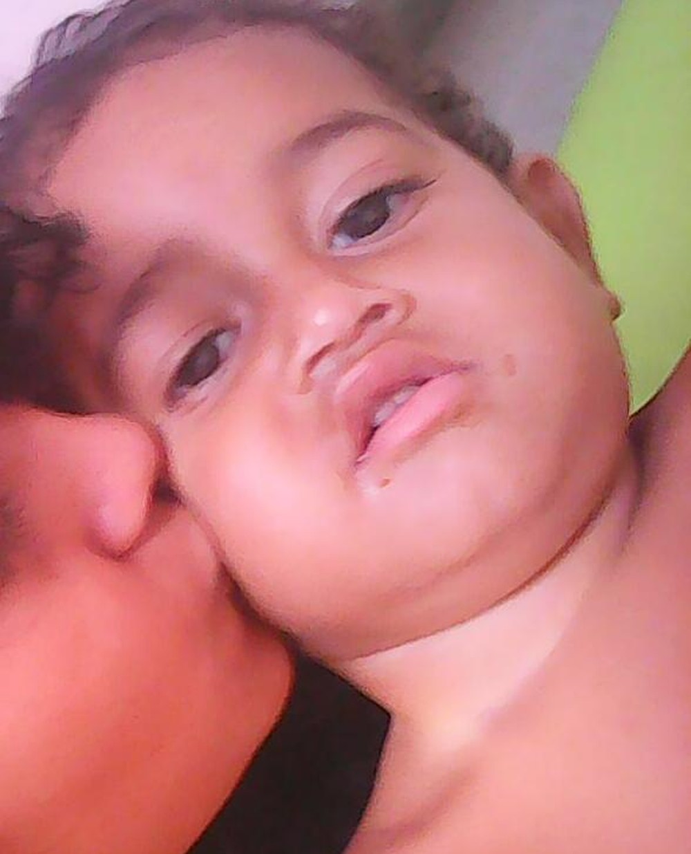 Bebê atingido com tiro na cabeça apresenta melhora, mas ficará parcialmente surdo