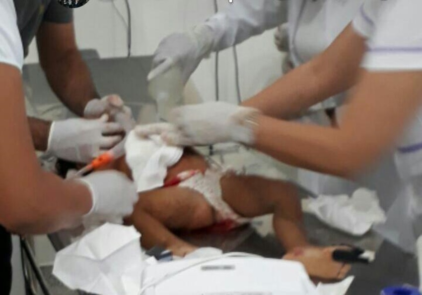 Criança de um ano e seis meses é baleada com tiro no rosto enquanto brincava no bairro Cabreúva