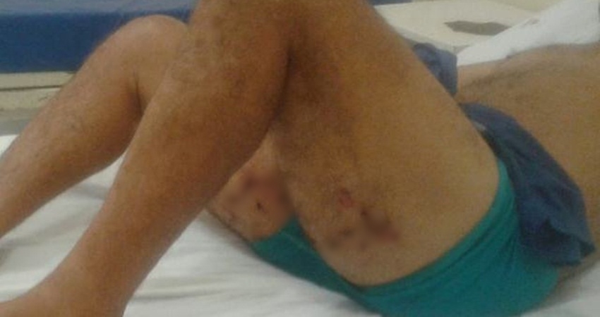 Colono sai para caçar antas, esquece onde estão armadilhas e acaba baleado nas duas coxas Colono sai para caçar antas, esquece onde estão armadilhas e acaba baleado nas duas coxas