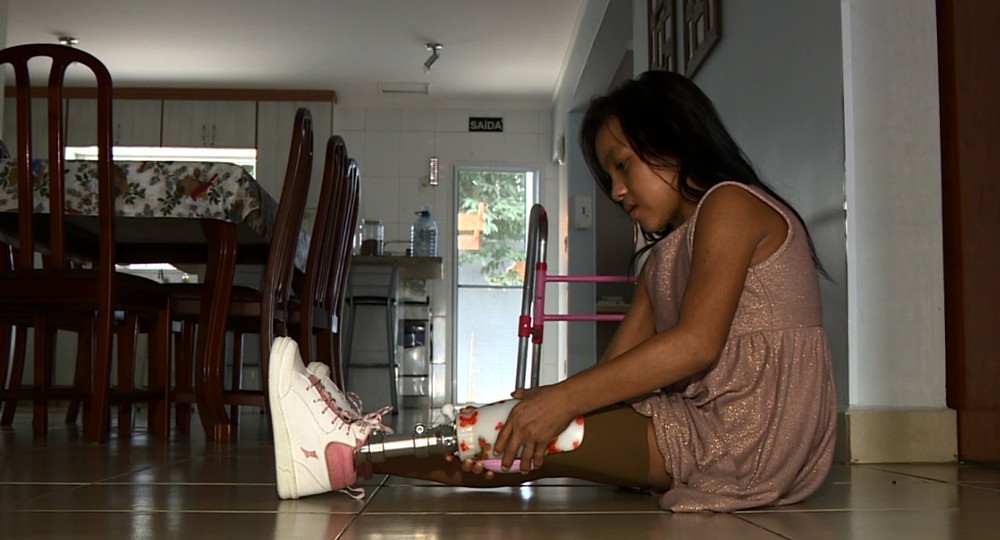 ONG garante tratamento e próteses para meninas acreanas em Campinas