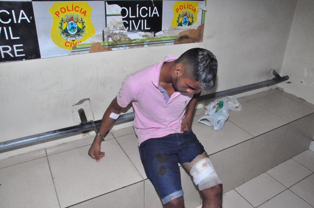 Rapaz de 18 anos acusado de assalto acaba preso depois de levar tiro na perna