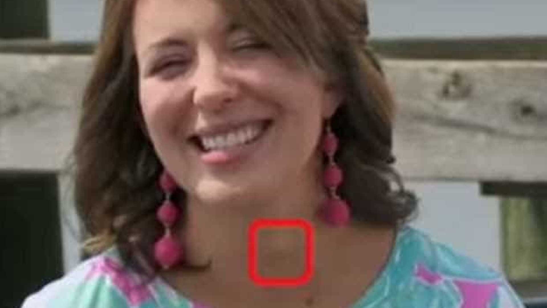 Mulher é diagnosticada com câncer por médico que a viu quando dava entrevista a uma TV
