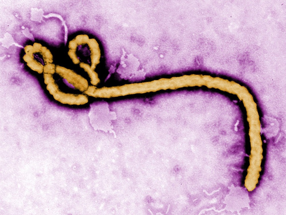 Cientistas quenianos garantem ter descoberto 2 vacinas contra o ebola