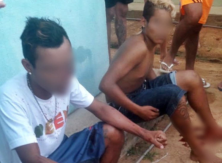 Criminosos de motocicleta abrem fogo e atingem três jovens na Cidade do Povo