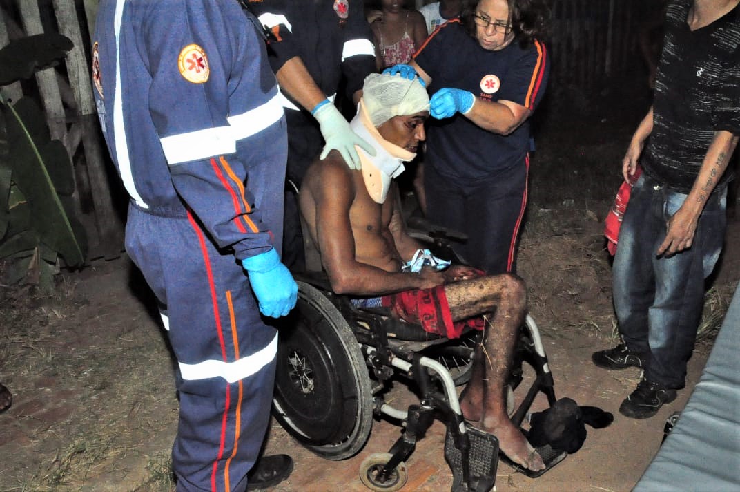 Cadeirante leva tiro de raspão na cabeça e vai parar no Pronto Socorro de Rio Branco